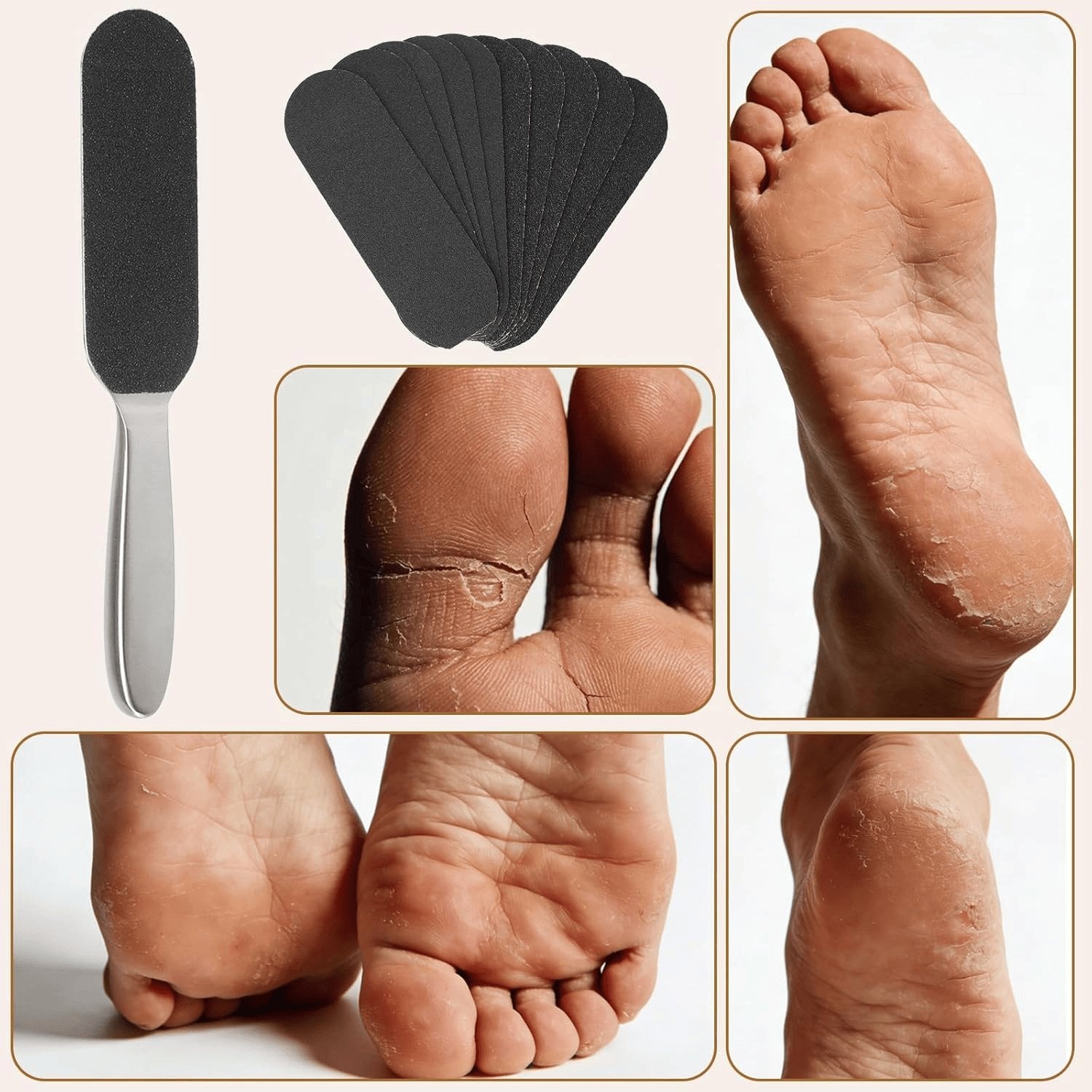 Hornhautentferner Fußfeile Set Mit Edelstahlgriff – 50 Stück Ersatzpads Für Hornhaut Entfernen & Fußpflege – Extra Große Raspel Für Ferse & Fußsohle – Perfekt Für Zuhause, Reise, Männer & Frauen